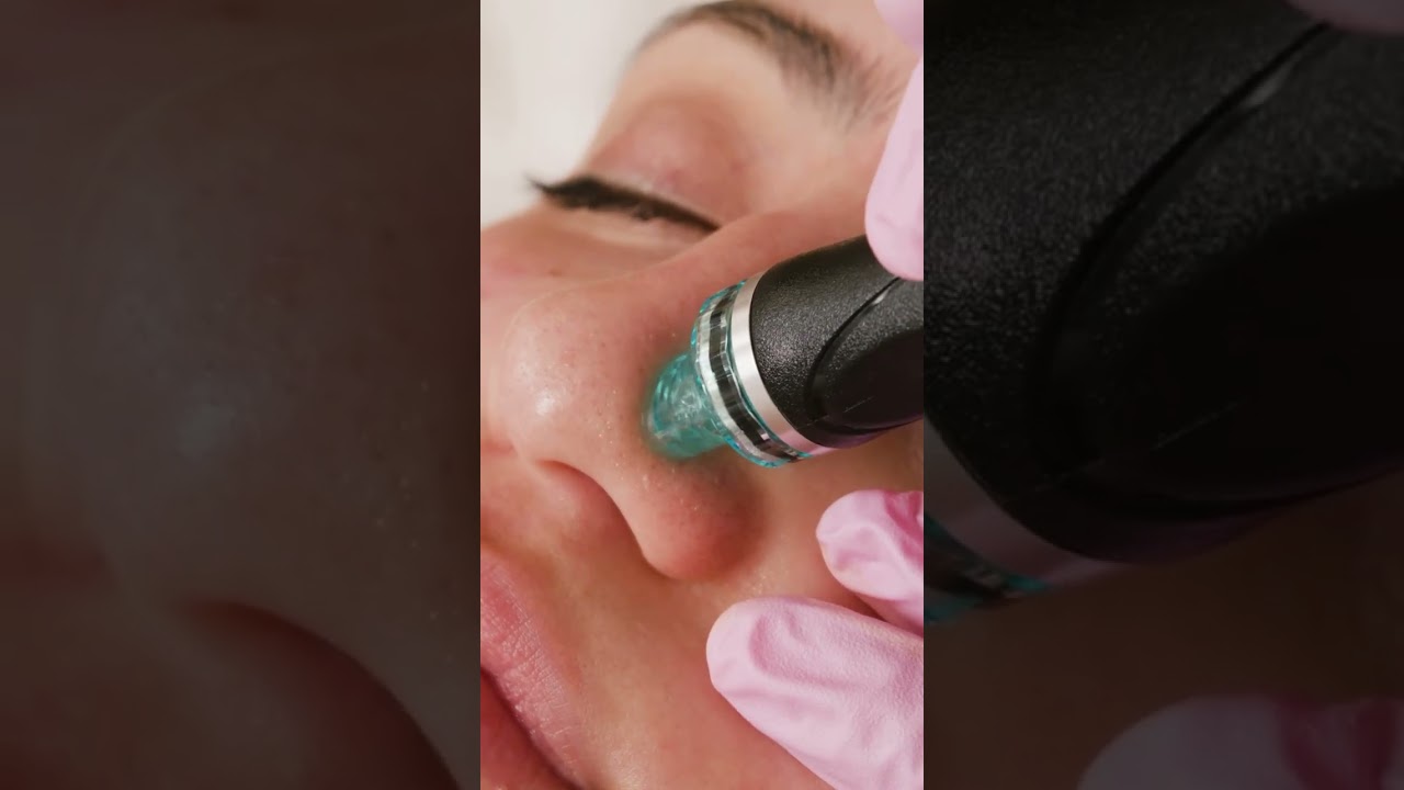 Hydrafacial