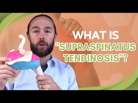 What is "Supraspinatus Tendinosis"? (shoulder pain)