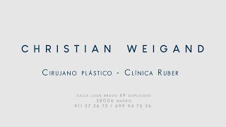 Mamas Tuberosas - Operación de pecho en Madrid - Dr Weigand