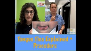 All Tied Up!  Understanding Tongue Tie and the Procedure Experience | Let's Talk About