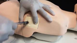 How to secure a chest tube