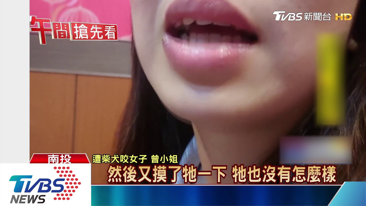 狗狗乖!女摸柴犬 慘遭咬臉嘴唇撕裂傷
