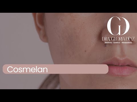 cosmelan