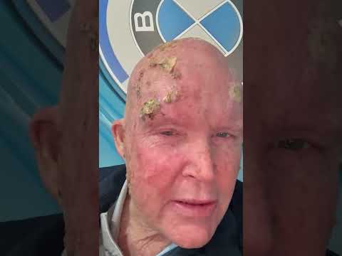 Oscar Chalupsky Health Update 02June 26