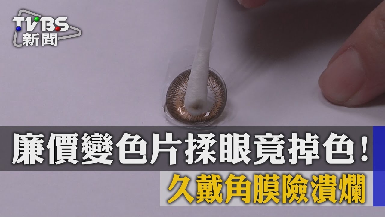 廉價變色片揉眼竟掉色！　久戴角膜險潰爛