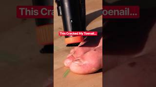 I Got Shot in the Toenail… It CRACKED #shorts #funny #comedy