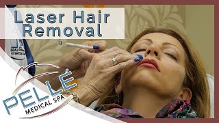 preview picture of video 'Laser Hair Removal in Manchester NH - Discounts - Pelle Medical Spa'