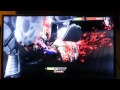 MK9 Human Cyrax X Ray Combo 71