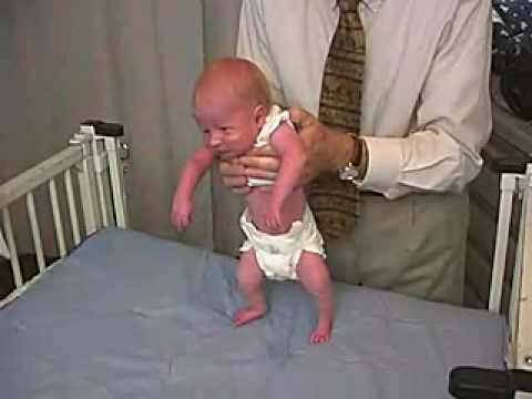 neurology exam: newborn-abnormal: Positions - Vertical Suspension