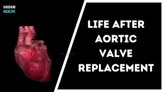 La vie après le remplacement de la valve aortique