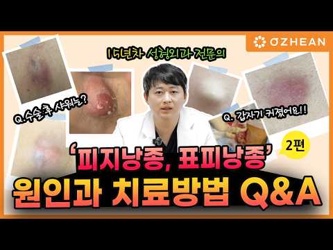 피지낭종, 표피낭종 대처법 Q&amp;A 2편 | 감염되면 어떻게 되나?! #종기 #혹 #양성종양 #여드름