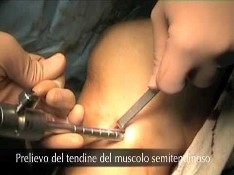 Che per il trattamento di articolazioni ginocchia Dieta per il dolore alle articolazioni delle dita