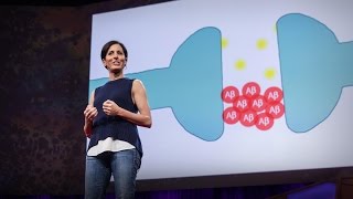 What you can do to prevent Alzheimer&#39;s | Lisa Genova
