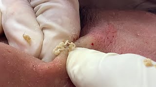Satisfying and Relaxation with SURI NGUYEN Beauty Spa Video #275