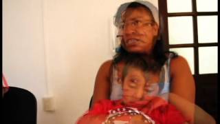 Testimonio: Atopic dermatitis