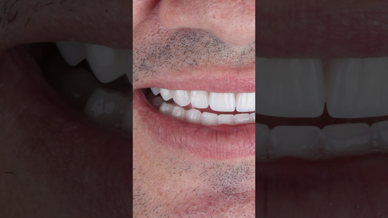 Danilo Monteiro Rezende Pereira-41