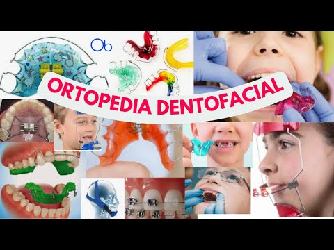 ¿Qué es la ORTOPEDIA DENTOFACIAL?