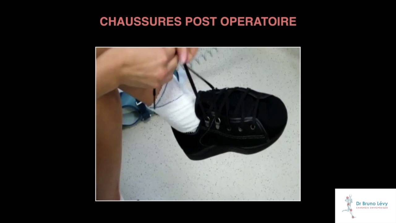 Dr Bruno LEVY - Chaussures orthopédiques hallux valgus