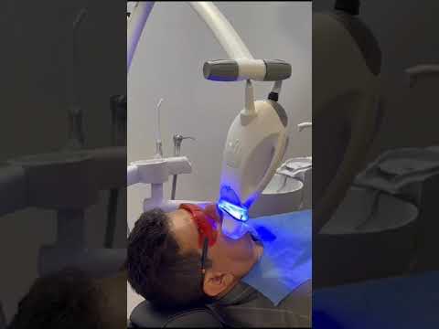 Blanqueamiento dental Cartagena Zoom en Smile Makeover por la Odontóloga Fanny Valera