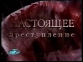 Teaser