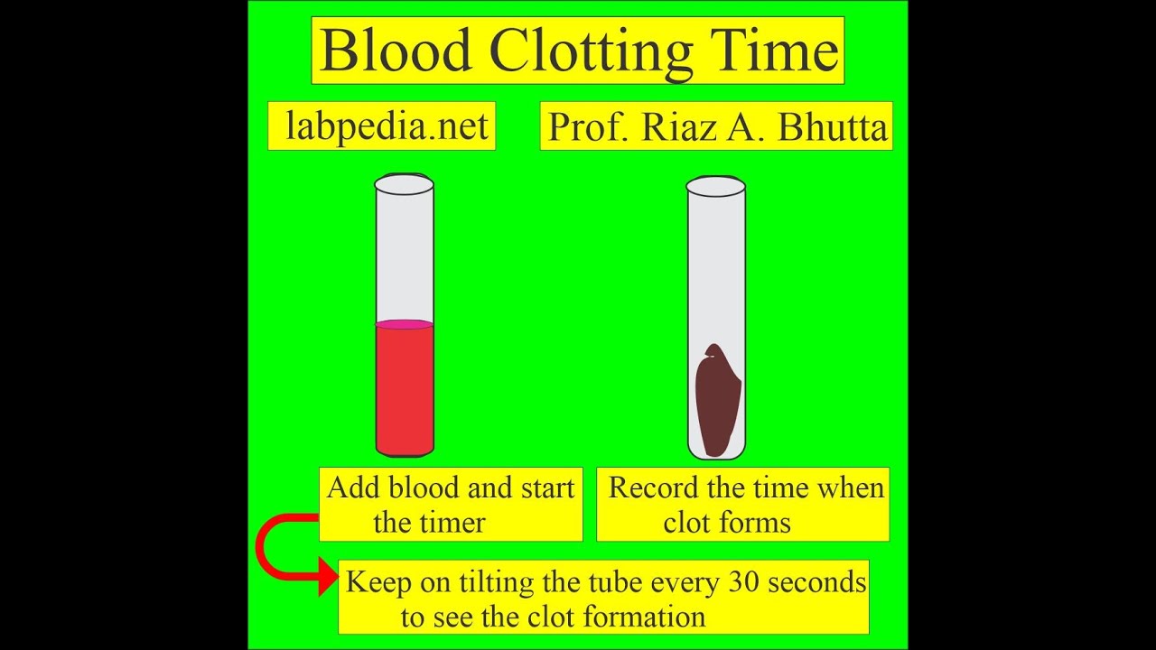 Blood clotting time (BT) by labpedia.net, Prof. Riaz A. Bhutta (Urdu, Hindi)