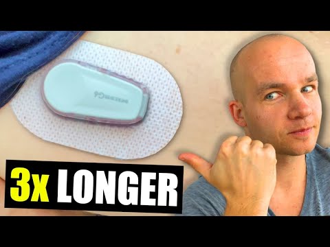 Restart Dexcom G6 Sensor | 2 Ways That Work in 2026