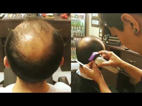 Aplicação de Prótese Capilar não cirúrgica by Débora Fuentes