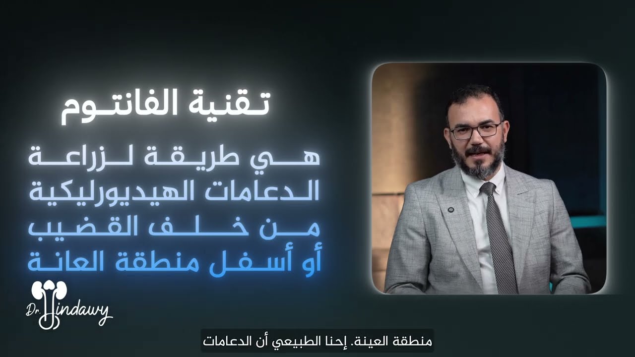 تقنية الفانتوم لزراعة الدعامات الهيدروليكية و المرنة