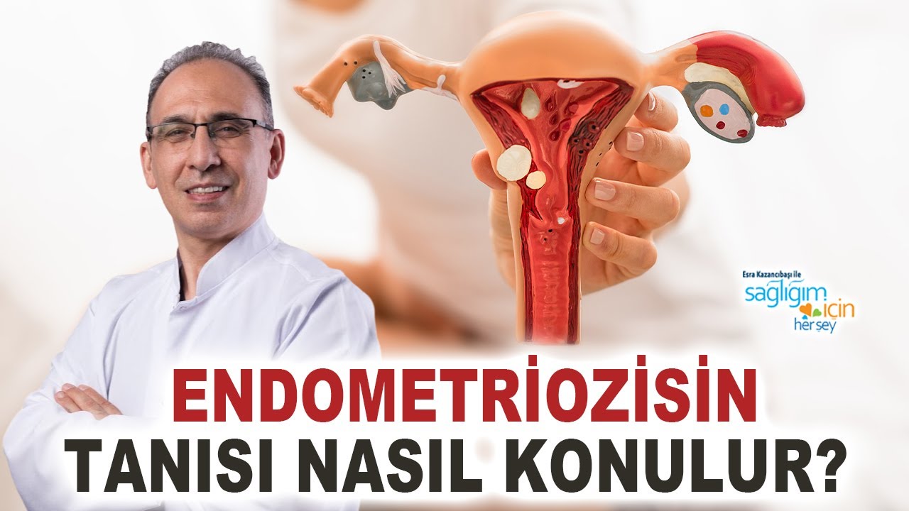 Endometriozisin Tanısı Nasıl Konulur?