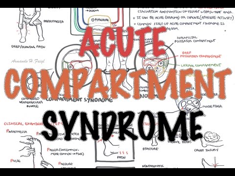 Acute Compartment Syndrome
