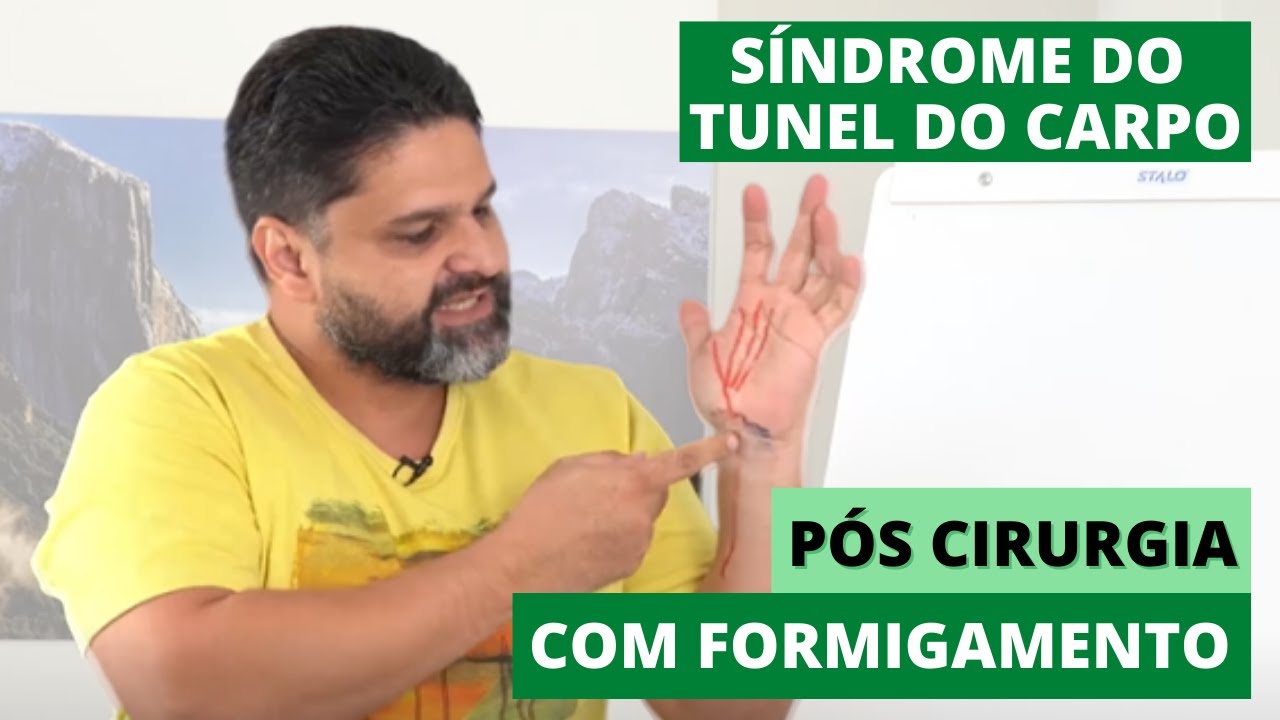 🖐️ Síndrome do túnel do carpo pós cirurgia com formigamento