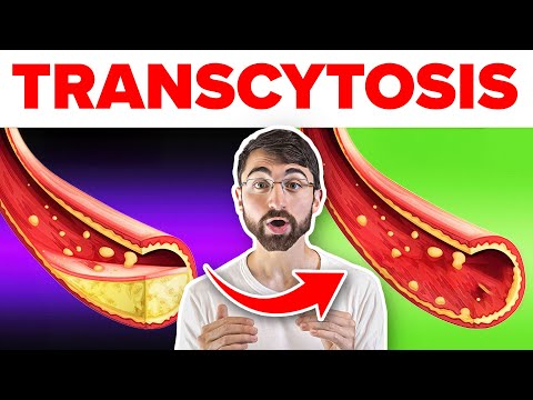 Why High LDL Cholesterol Doesn’t Always Lead to Heart Disease