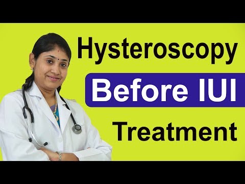 Hysteroscopy before IUI Treatment in tamil | IUI