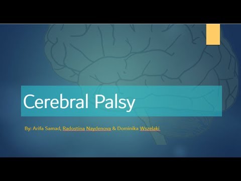 Watch lagu Images Videos Cerebral Palsy Powerpoint Lecture, Watch Images Cerebral Palsy Powerpoint Lecture free Watchn, video klip Cerebral Palsy Powerpoint Lecture