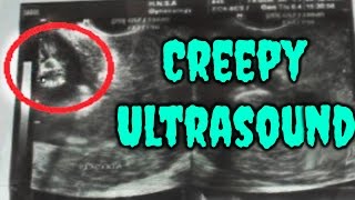 Creepy Ultrasound Images - GloomyHouse