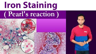 Iron Staining Clear Explain ( Pearl's stain / Prussian blue reaction )