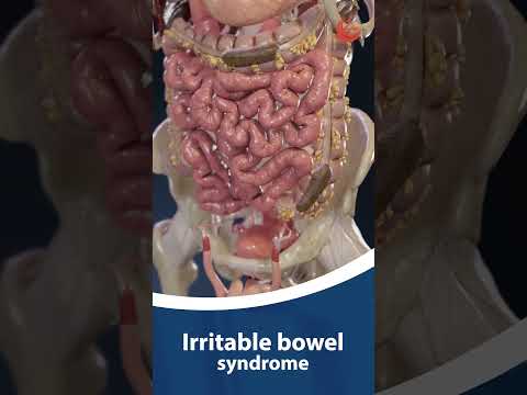Irritable Bowel Syndrome (IBS) - What You Need to Know | Dr. Sohail Hussain