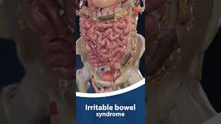 Download lagu Irritable Bowel Syndrome (IBS) - What You Need to Know | Dr. Sohail Hussain mp3