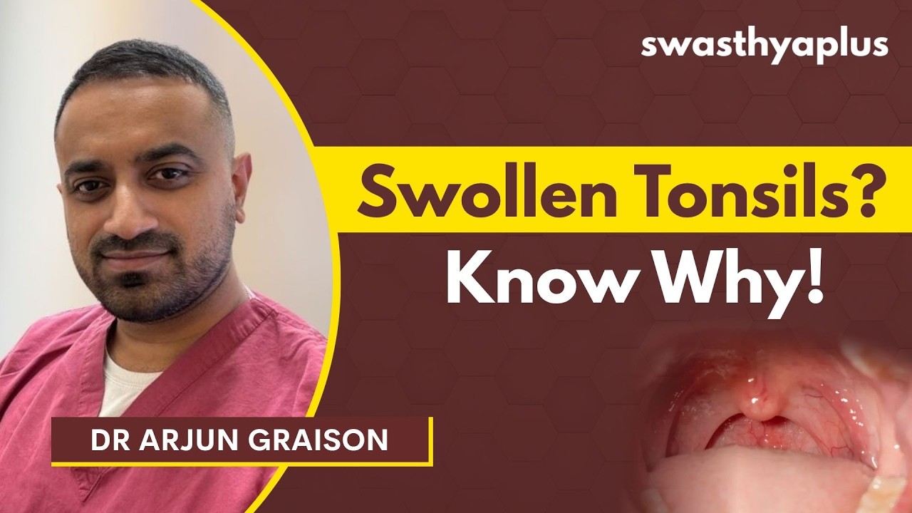 Tonsillitis: Who is at Risk? | Causes & Symptoms | Dr Arjun Graison