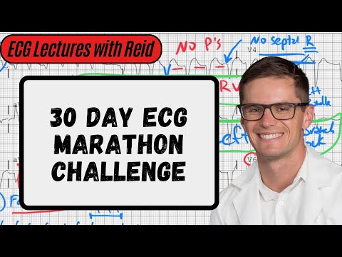 Normal Sinus Rhythm | Day 1 ECG Challenge
