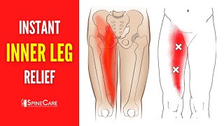 How to Fix Inner Leg Pain FOR GOOD