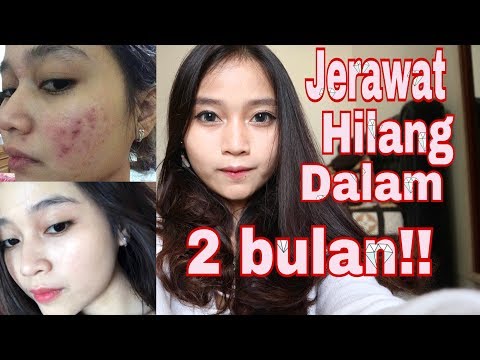 Apakah dari protein untuk menurunkan berat badan jika Anda terlibat dalam olahraga Ski untuk ulasan penurunan berat badan