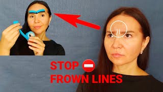 How to get rid of FROWN LINES overnight