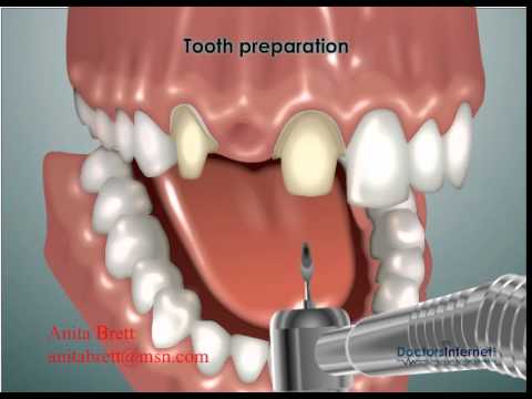 Take a look thumbnail