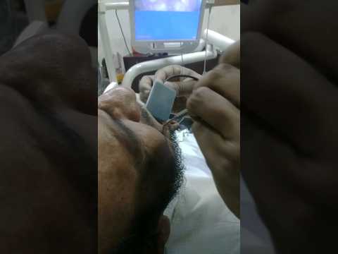 RVG X-Ray | #shorts | #youtubeshorts