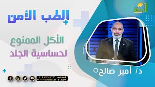 الأكل الممنوع لحساسية الجلد || برنامج الطب الأمن مع د/  أمير صالح