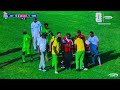 Ona Pacome Alivyovunjika Mguu Leo Inasikitisha