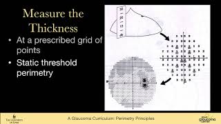 Perimetry principles types of perimetry: Kinetic, static threshold, SWAP, FDT