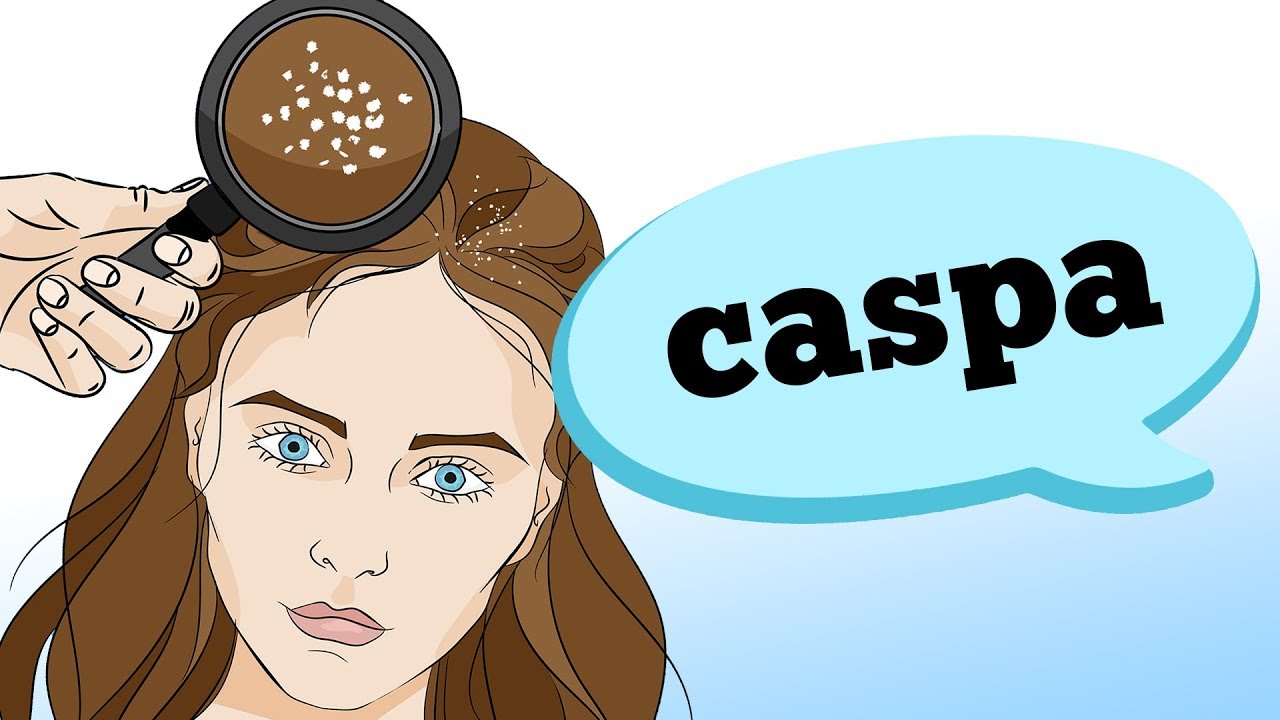 O QUE CAUSA CASPA?