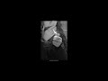 Post Malone Congratulations Slowed Reverb